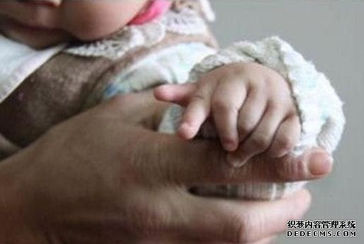畸形婴儿 有数小孩出生有12个手指