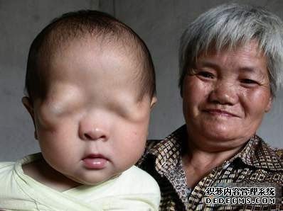 生成无眼小宝宝解开惊人答案