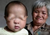 ��������С�����⿪���˴�