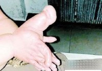 ϡ��Ĳ� ��Ĵָ�緲�˵���һ����