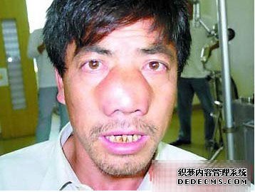 ϡ��Ĳ� ��Ĵָ�緲�˵���һ����