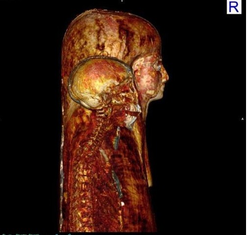 ½ÒÃØ3000Äêǰ°£¼°Ä¾ÄËÒÁÃÕÍÅ ¹Å°£¼°ÎÄÃ÷