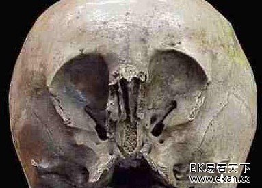 ����ͷ�����������˵����˻�Ѫ