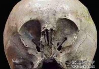 ����ͷ�����������˵����˻�Ѫ