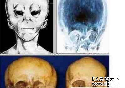 独特头骨疑似外星人地球人混血