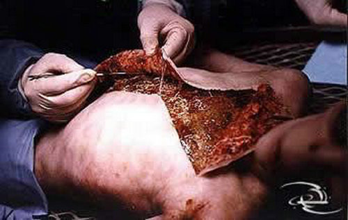 令人震惊的外星人剖解隐秘照片被曝光(图)