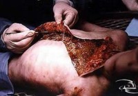 �����𾪵��������ʽ�������Ƭ���ع⣨ͼ��